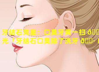 牙结石克星：口臭牙黄一扫 🐵 光「牙结石口臭除了洗牙 🕷 以外,怎么去除」